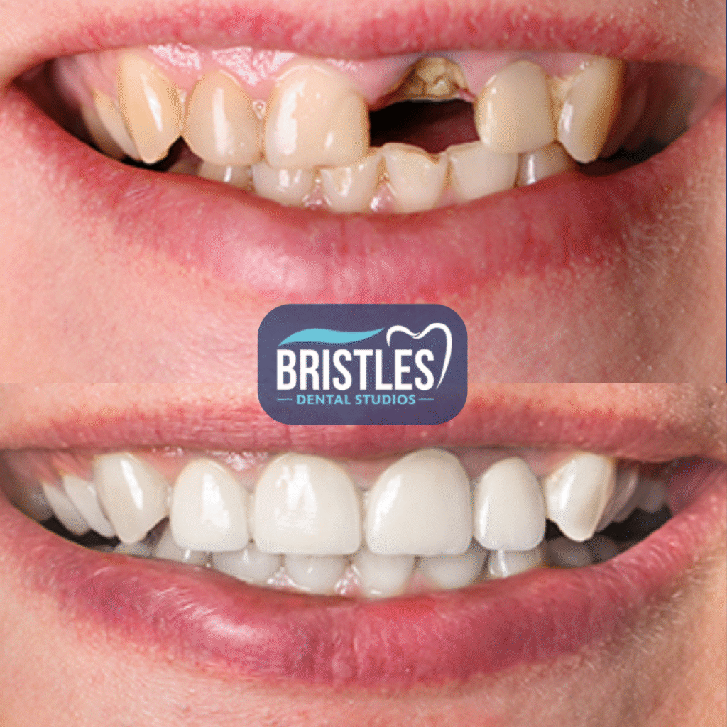 Bristle Dental (2)