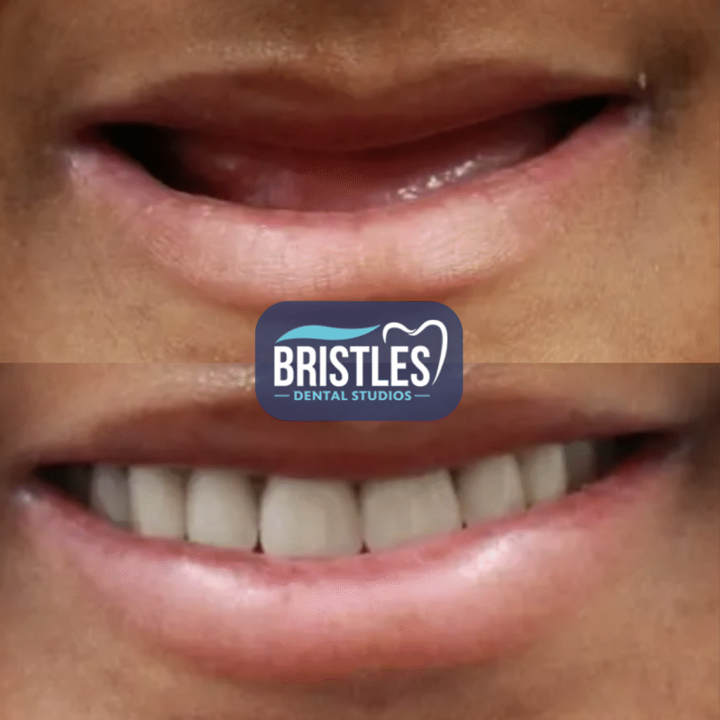 Bristle Dental (3)