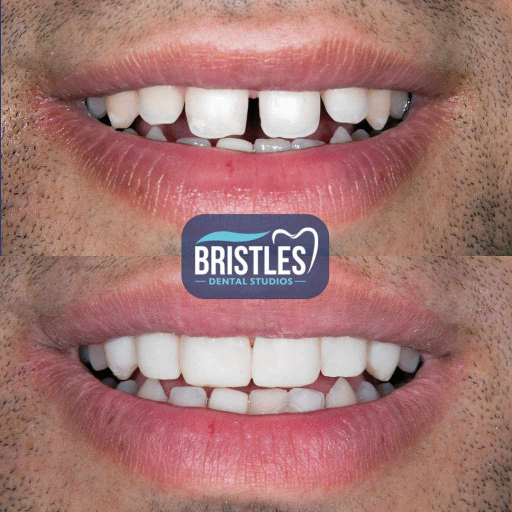 Bristle Dental (4)