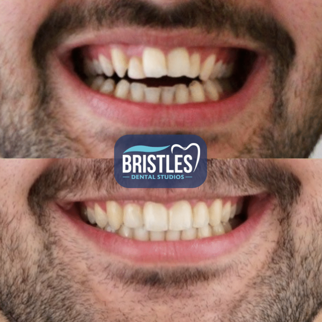 Bristle Dental (6)